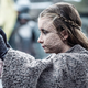 Illustration for article titled How Greyscale In iGame Of Thrones/i Compares To The Real Story Of Leprosy